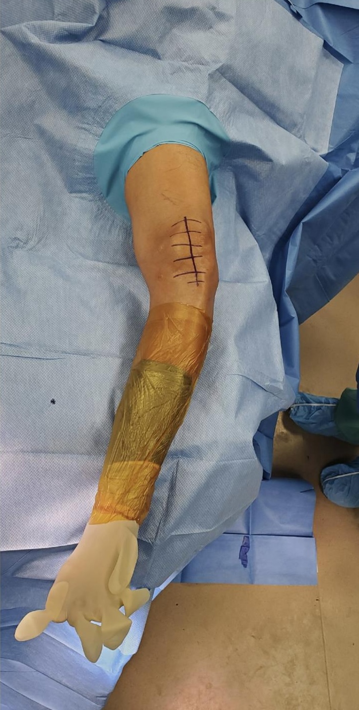 https://upload.orthobullets.com/cases/102196/jm-b1.jpg