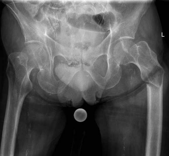 https://upload.orthobullets.com/cases/102522/a1.jpg