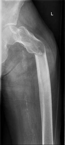 https://upload.orthobullets.com/cases/102522/a2.jpg