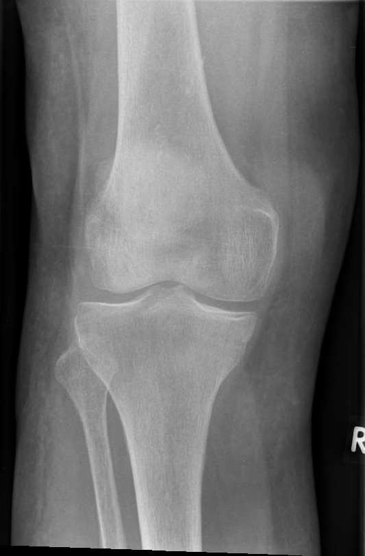https://upload.orthobullets.com/cases/102583/a1.jpg