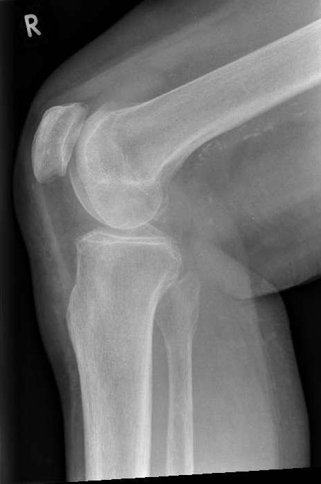https://upload.orthobullets.com/cases/102583/a2.jpg
