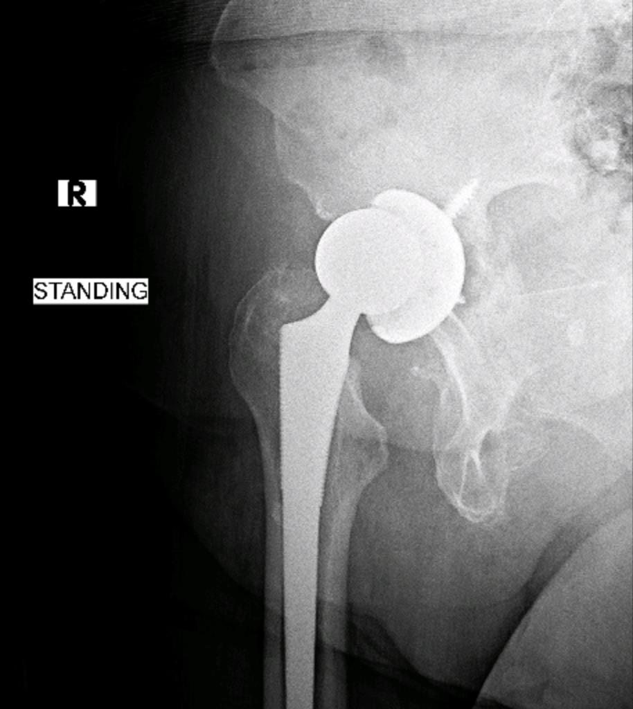 https://upload.orthobullets.com/cases/102631/d1.jpg