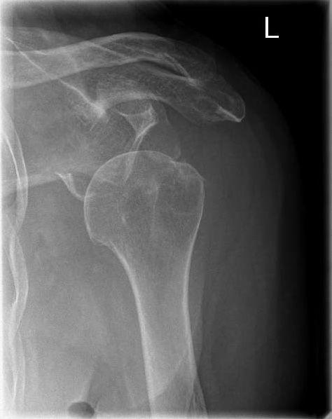 https://upload.orthobullets.com/cases/102671/a1.jpg