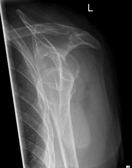 https://upload.orthobullets.com/cases/102671/a2.jpg
