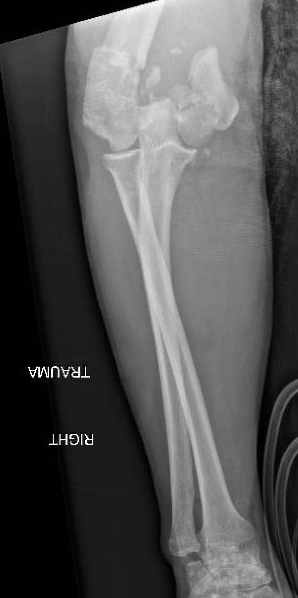 https://upload.orthobullets.com/cases/102753/a2.jpg