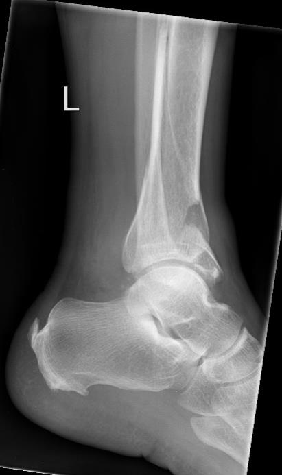 https://upload.orthobullets.com/cases/102762/9d11afe4-63e8-4cc9-ae31-13b962561f60_a2.jpg