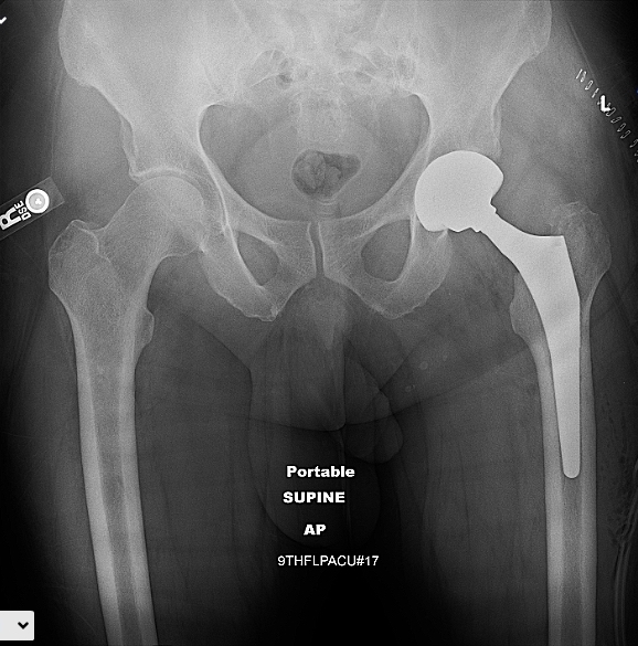 https://upload.orthobullets.com/cases/102765/a2.jpg