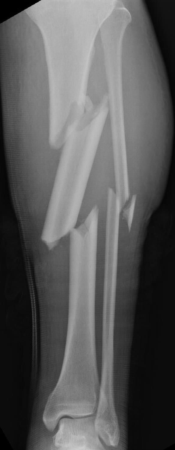 https://upload.orthobullets.com/cases/102776/a1.jpg