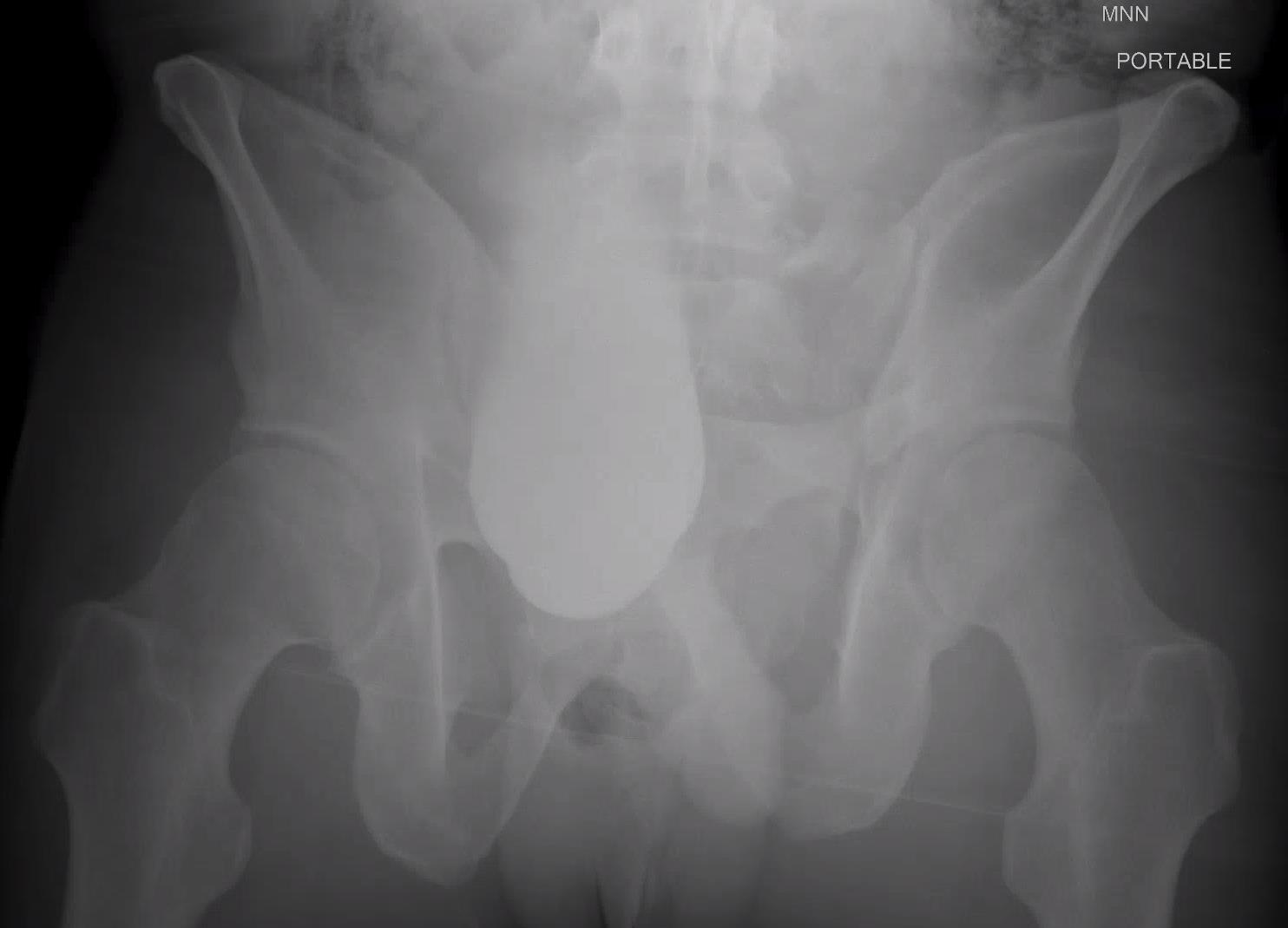 https://upload.orthobullets.com/cases/102781/a2.jpg
