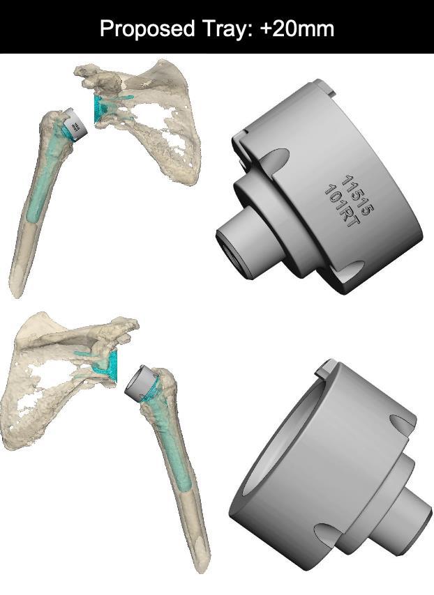 https://upload.orthobullets.com/cases/102784/716c1bcf-59ef-4b7d-92d1-10d2b61dd288_b1.jpg