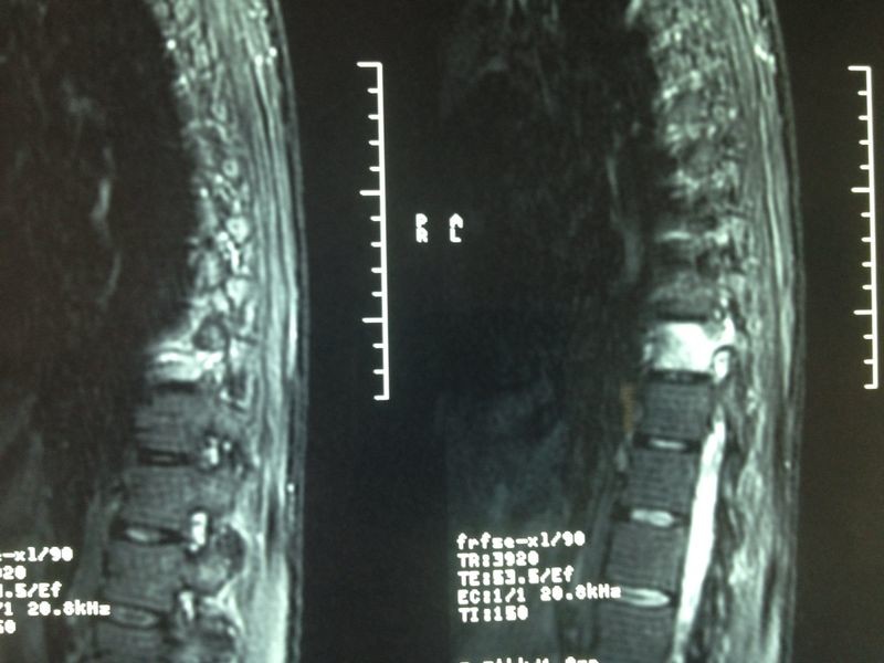 Differential Groups - Pathology - Orthobullets