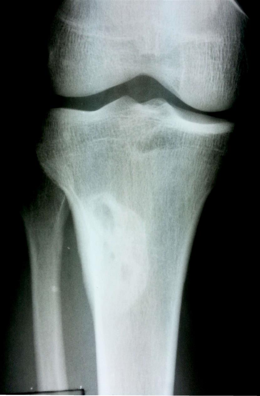 Soft Tissue Pathology Orthobullets