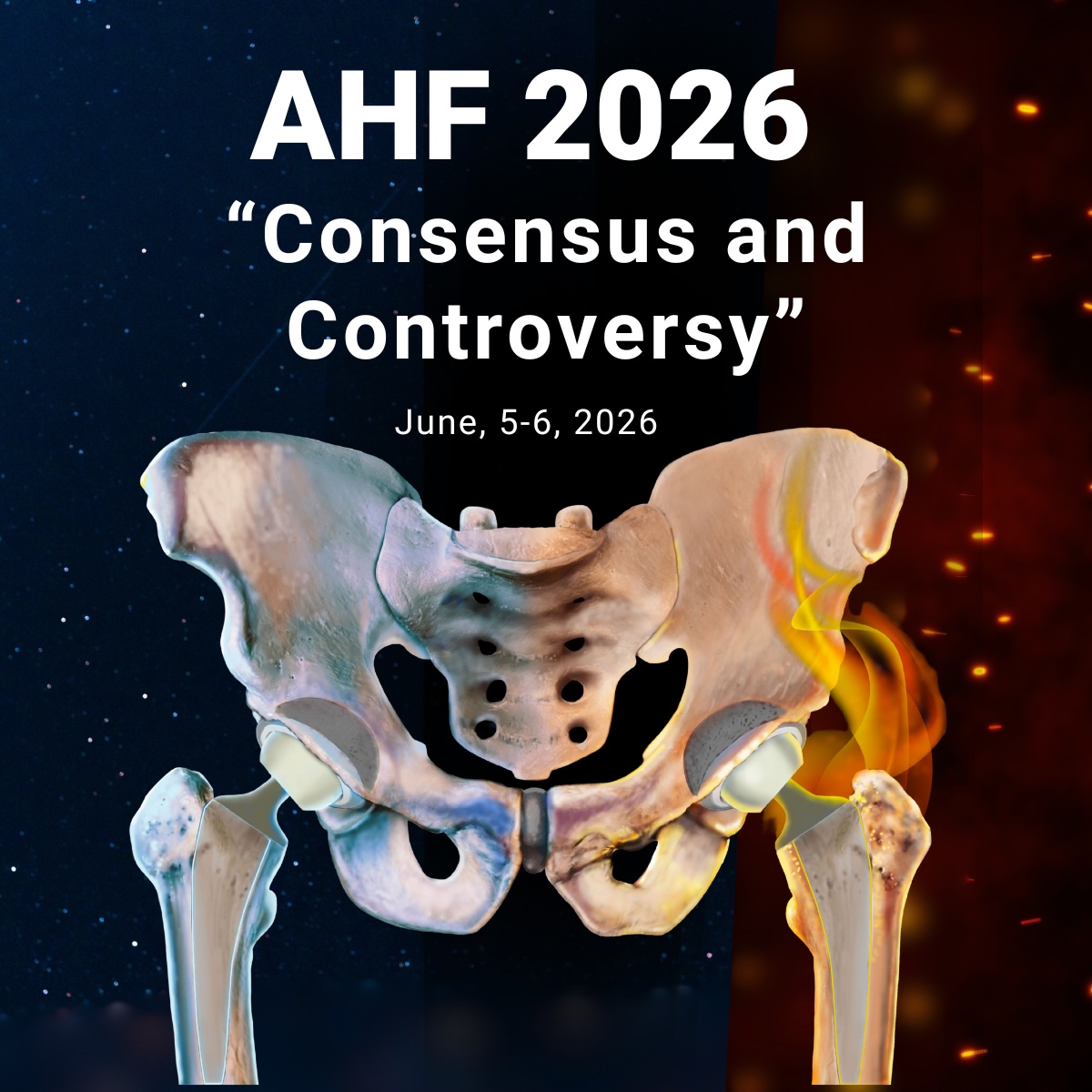 https://upload.orthobullets.com/event/9704/45f2c46b-5eee-4240-803f-140724125ef5_consensus_and_controversy.jpg