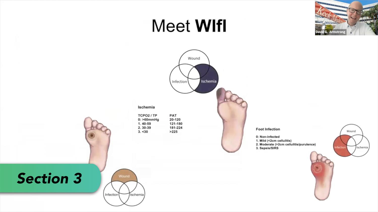 https://upload.orthobullets.com/event/9918/1e6ef37e-2604-41b0-a5b8-2e25b21122e3_rsh_thumbnail_3_06_25_v1.jpg