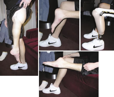 Question 158 - Qbank - Orthobullets