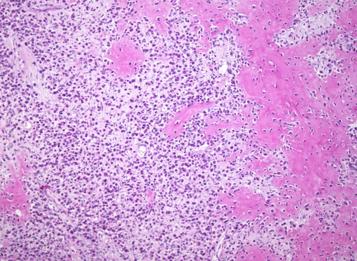 The Shocking Truth About Chondro Related Diseases - 5snz1w0