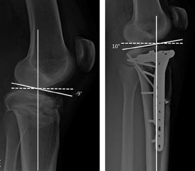 Question 219159 - Qbank - Orthobullets