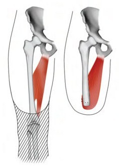 Amputations - Trauma - Orthobullets