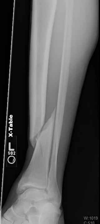 Question 3992 - Qbank - Orthobullets