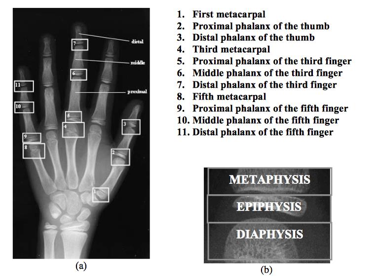 Question 4536 Qbank Orthobullets