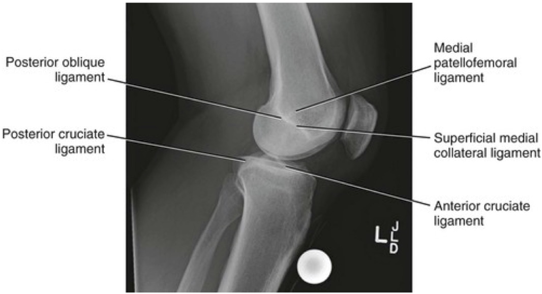 Adult Knee Radiographic Views Trauma Orthobullets